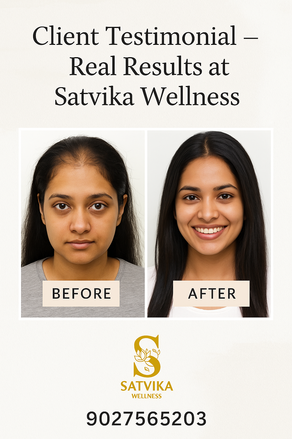 GFC vs. PRP: Which Hair Loss Treatment Is Better for You?